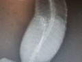 radiography xray 01